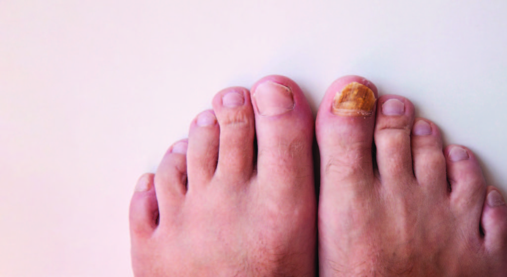 Podiatry Myths Debunked – Get Your Facts Right and Take Care of Your Feet