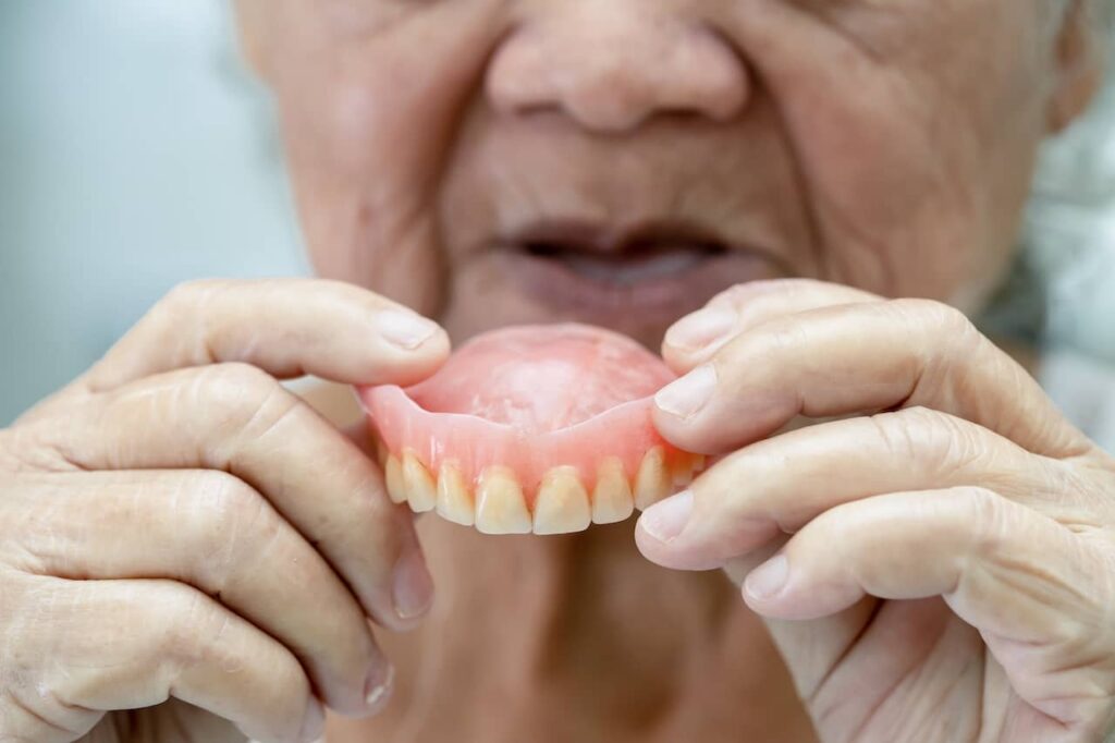 What You May Want to Know About Wearing Dentures in Wichita Falls