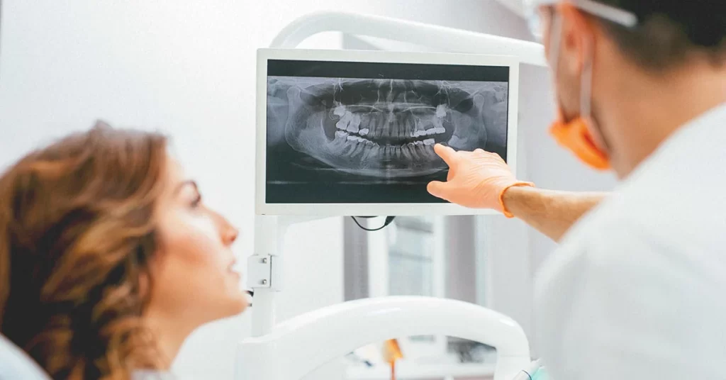 Why Should You Get X-Rays When Facing Oral Health Issues?