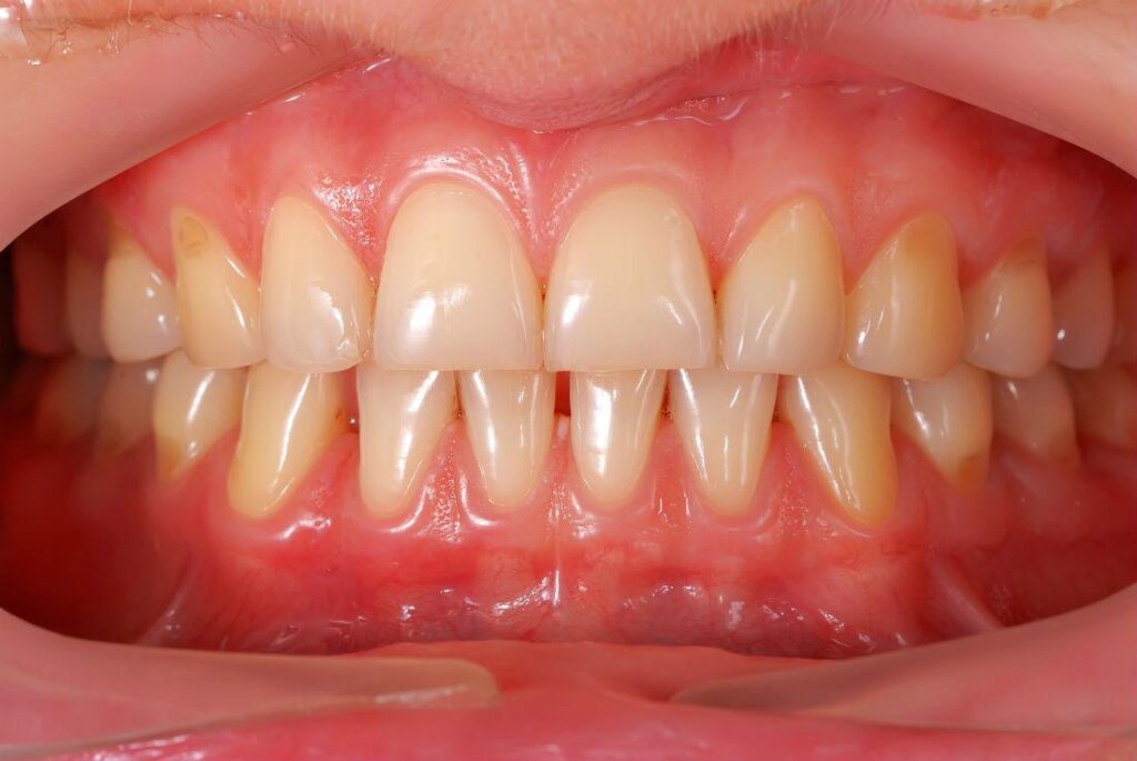 Tips to keep my gums healthy
